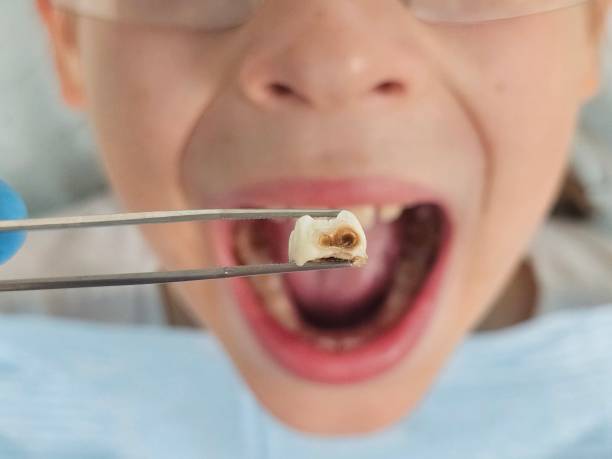 Best Orthodontic Emergency Dentist in Boonville, CA