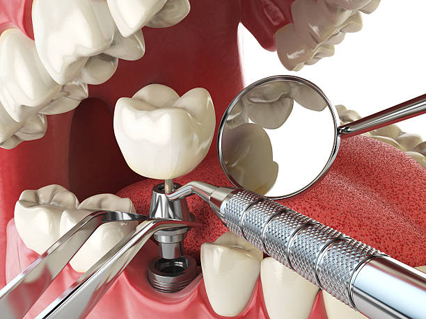 Best 24-Hour Emergency Dentist in Boonville, CA